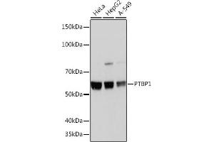 Western blot analysis of extracts of various cell lines, using PTBP1 Rabbit mAb (ABIN7269464) at 1:1000 dilution. (PTBP1 antibody)