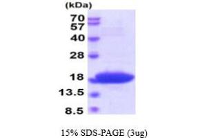 SDS-PAGE (SDS) image for DnaK (AA 508-638) protein (ABIN666807) (DnaK (AA 508-638) Protein)