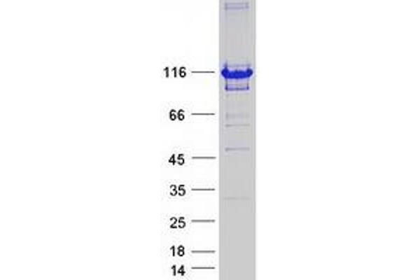 PPP1R9B Protein (Myc-DYKDDDDK Tag)