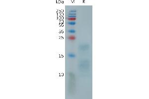 Monkeypox virus A29L Protein, His Tag on SDS-PAGE under reducing condition. (MPXV A29L (AA 1-110) protein (His tag))