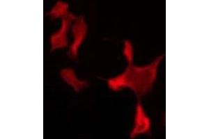 ABIN6274087 staining 293 by IF/ICC. (VWA5A antibody  (Internal Region))