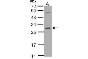 WB Image Sample (30 ug of whole cell lysate) A: Hep G2 , 12% SDS PAGE antibody diluted at 1:1000 (RALB antibody  (full length))