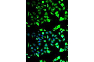 Immunofluorescence analysis of HeLa cells using XIAP antibody (ABIN6130929, ABIN6150289, ABIN6150292 and ABIN6217214). (XIAP antibody  (AA 1-200))