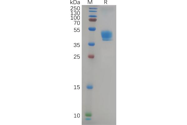 CCR9 Protein (AA 1-48) (Fc Tag)