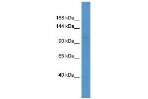 WB Suggested Anti-MAP4 Antibody Titration: 0. (MAP4 antibody  (N-Term))