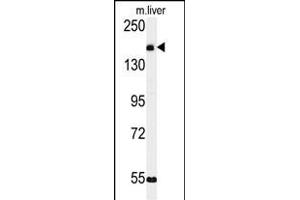 Western blot analysis of KI Antibody (C-term) (ABIN651358 and ABIN2840200) in mouse liver tissue lysates (35 μg/lane). (CCDC180 antibody  (C-Term))
