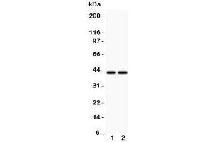 Western blot testing of CD244 antbody and  Lane 1: MCF-7;  2: HeLa (2B4 antibody  (C-Term))