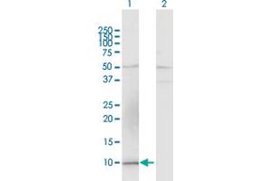 Western Blot analysis of CCL15 expression in transfected 293T cell line by CCL15 MaxPab polyclonal antibody. (CCL15 antibody  (AA 1-113))