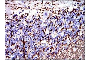 Immunohistochemistry (IHC) image for anti-Myelin Basic Protein (MBP) antibody (ABIN969279)