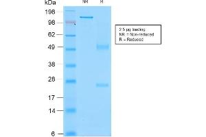 SDS-PAGE (SDS) image for anti-Sialophorin (SPN) antibody (ABIN6940632)