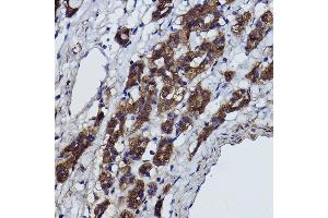 Immunohistochemistry of paraffin-embedded Rat heart using α-Smooth Muscle Actin  Rabbit pAb (ABIN6127402, ABIN6136473, ABIN6136476 and ABIN6214239) at dilution of 1:25 (40x lens). (Smooth Muscle Actin antibody  (AA 1-124))