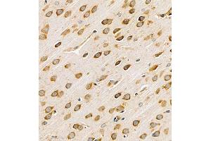 Immunohistochemistry of paraffin embedded rat brain using Neurokinin-A (ABIN7075824) at dilution of 1:1100 (400x lens) (NKA antibody)