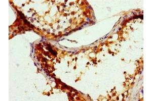 Immunohistochemistry of paraffin-embedded human testis tissue using ABIN7168570 at dilution of 1:100 (SGF29 antibody  (AA 1-293))