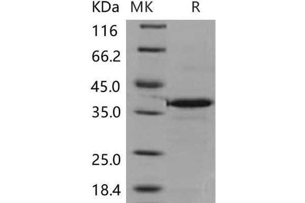 CA8 Protein (His tag)