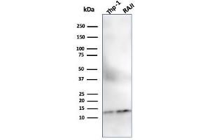 Western Blot Analysis of THP-1 and Raji Cell lysate using Beta-2-Microglobulin MAb (SPM617). (beta-2 Microglobulin antibody)