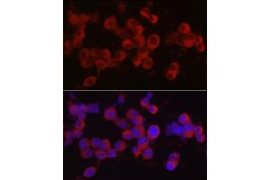 Immunofluorescence analysis of Neuro-2a cells using Ret Rabbit pAb (ABIN6130657, ABIN6146873, ABIN6146874 and ABIN6213585) at dilution of 1:50 (40x lens). (Ret Proto-Oncogene antibody  (AA 29-300))