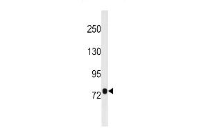 Western blot analysis in MDA-MB453 cell line lysates (35ug/lane). (C9orf3 antibody  (N-Term))