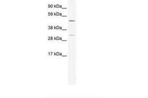 Image no. 1 for anti-Calcium/calmodulin-Dependent Protein Kinase IV (CAMK4) (AA 326-375) antibody (ABIN202605) (CAMK4 antibody  (AA 326-375))