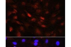 Immunofluorescence analysis of C6 cells using PLK1 Polyclonal Antibody at dilution of 1:100 (40x lens). (PLK1 antibody)