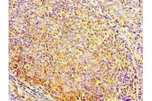 Immunohistochemistry of paraffin-embedded human tonsil tissue using ABIN7150705 at dilution of 1:100 (MAP2K3 antibody  (AA 1-170))