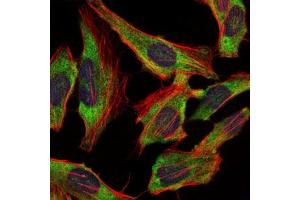 Immunofluorescence (IF) image for anti-Neurofilament, Light Polypeptide (NEFL) antibody (ABIN1108417) (NEFL antibody)