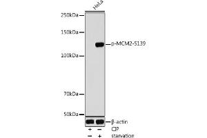 Western blot analysis of extracts of HeLa cells, using Phospho-MCM2-S139 antibody (ABIN7268539) at 1:1000 dilution. (MCM2 antibody  (pSer139))