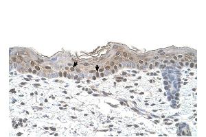 Arrestin B2 antibody was used for immunohistochemistry at a concentration of 4-8 ug/ml to stain Squamous epithelial cells (arrows) in Human Skin. (Arrestin 3 antibody  (Middle Region))