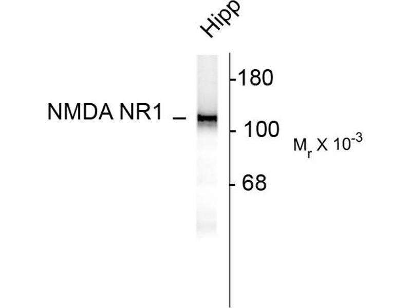 Nmdar1 outlet