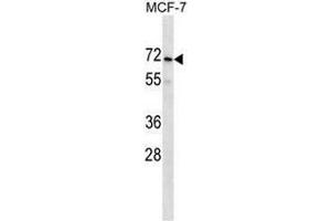 PRAMEF2 Antibody (C-term) western blot analysis in MCF-7 cell line lysates (35µg/lane). (PRAMEF2 antibody  (C-Term))