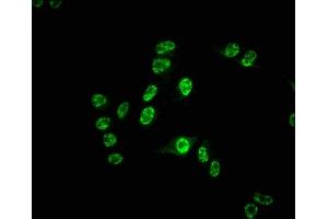 Immunofluorescence (IF) image for anti-Cell Division Cycle 25 Homolog C (S. Pombe) (CDC25C) antibody (ABIN7127412)