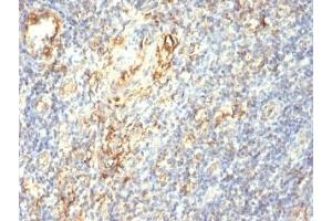 Immunohistochemistry (Formalin-fixed Paraffin-embedded Sections) (IHC (fp)) image for anti-Transglutaminase 2 (C Polypeptide, Protein-Glutamine-gamma-Glutamyltransferase) (TGM2) antibody (ABIN3025598)