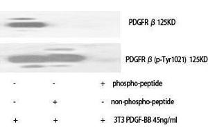Western Blotting (WB) image for anti-Platelet Derived Growth Factor Receptor beta (PDGFRB) (Thr220) antibody (ABIN3187584) (PDGFRB antibody  (Thr220))