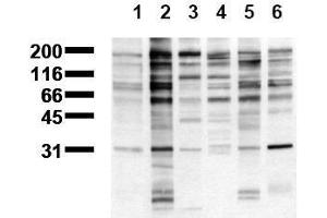 Western Blotting (WB) image for anti-Phosphotyrosine (phosphorylated) antibody (Biotin) (ABIN126872) (Phosphotyrosine antibody  (phosphorylated) (Biotin))