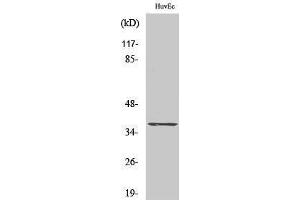 Western Blotting (WB) image for anti-Nuclear Factor of kappa Light Polypeptide Gene Enhancer in B-Cells Inhibitor, alpha (NFKBIA) (Thr17) antibody (ABIN3180127) (NFKBIA antibody  (Thr17))