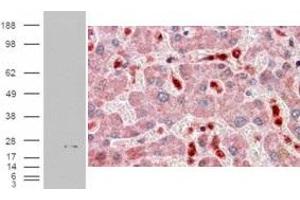 Immunohistochemistry (IHC) image for anti-PYD and CARD Domain Containing (PYCARD) (C-Term) antibody (ABIN2465287) (PYCARD antibody  (C-Term))