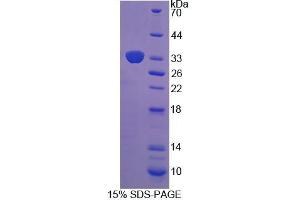 SDS-PAGE (SDS) image for Xylosyltransferase II (XYLT2) (AA 596-865) protein (His tag) (ABIN6238896) (XYLT2 Protein (AA 596-865) (His tag))