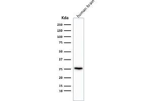 Western Blot Analysis of human brain tissue lysate using Pgp9. (Recombinant UCHL1 antibody)