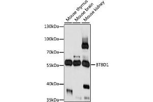 Western blot analysis of extracts of various cell lines, using BTBD1 antibody (ABIN7265952) at 1:1000 dilution. (BTBD1 antibody  (C-Term))