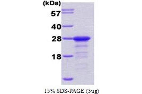 PPP1R1A Protein (AA 1-171) (His tag)