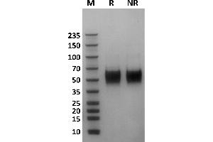 FCGR3A Protein (AA 17-208) (His-Avi Tag,Biotin)