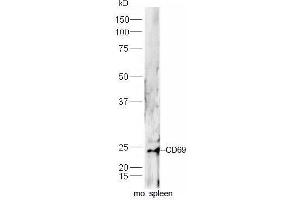 Mouse spleen lysates probed with Rabbit Anti-CD69 Polyclonal Antibody, Unconjugated  at 1:5000 for 90 min at 37˚C. (CD69 antibody  (AA 101-199))