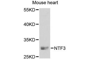 Western blot analysis of extracts of mouse heart, using NTF3 antibody. (Neurotrophin 3 antibody)