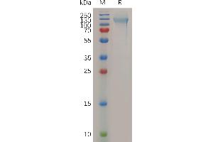 Human NCL Protein, His Tag on SDS-PAGE under reducing condition. (Nucleolin Protein (NCL) (AA 2-710) (His tag))