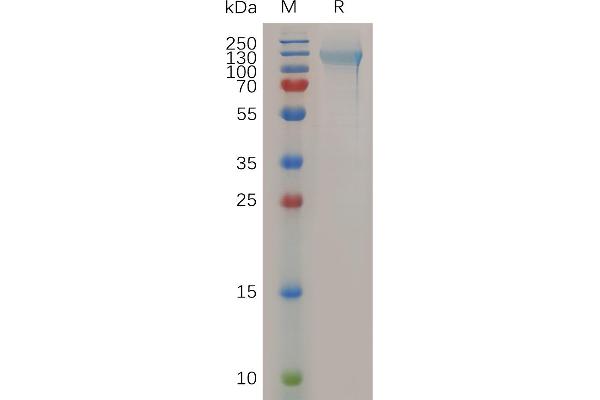 Nucleolin Protein (NCL) (AA 2-710) (His tag)