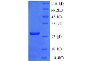 SDS-PAGE (SDS) image for Glutathione S-Transferase pi 1 (GSTP1) (AA 2-210) protein (His tag) (ABIN5712726) (GSTP1 Protein (AA 2-210) (His tag))