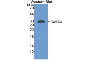 Western Blotting (WB) image for anti-Complement Component Receptor 1 (CD35) (CR1) (AA 1780-2039) antibody (ABIN1858484) (CD35 antibody  (AA 1780-2039))