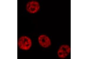 ABIN6267674 staining HepG2 by IF/ICC. (PDCD4 antibody  (pSer457))