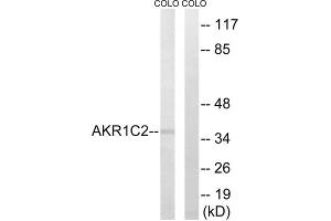 Western blot analysis of extracts from COLO cells, using AKR1C2 antibody. (AKR1C2 antibody  (Internal Region))