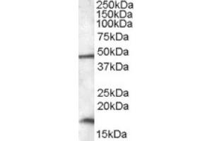 Image no. 1 for anti-RNA Binding Motif Protein 3 (RBM3) (C-Term) antibody (ABIN375136) (RBM3 antibody  (C-Term))