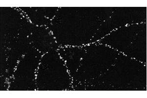 Immunohistochemistry (IHC) image for anti-Discs, Large Homolog 4 (Drosophila) (DLG4) antibody (ABIN6658152)